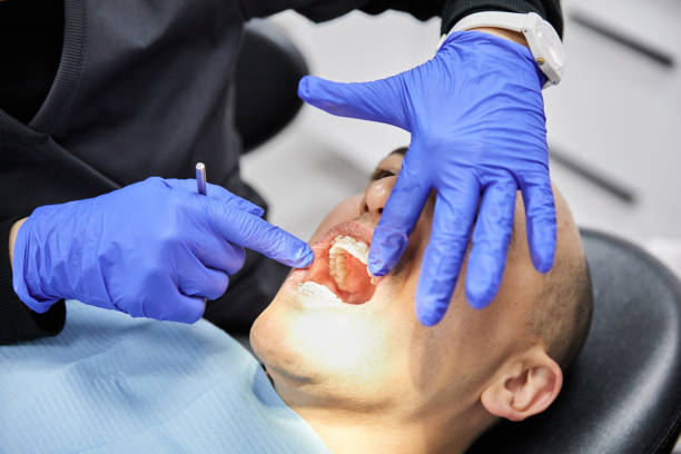 Best Same-Day Emergency Dental Services in Apple Mountain Lake, VA