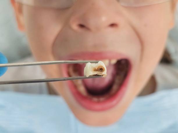 Best Emergency Denture Repair in Apple Mountain Lake, VA